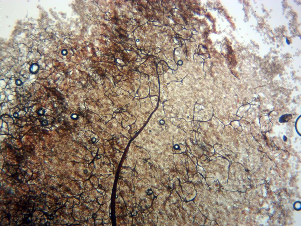Microscopía de Stemonitis axifera - 14 - Capilicio x 100